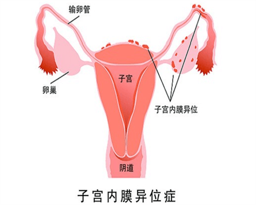 长沙子宫内膜增厚怎么治疗：子宫内膜厚子宫增大如何治疗好