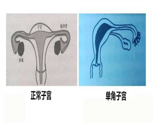 广州现在代孕多少钱-广州代孕的基本情况