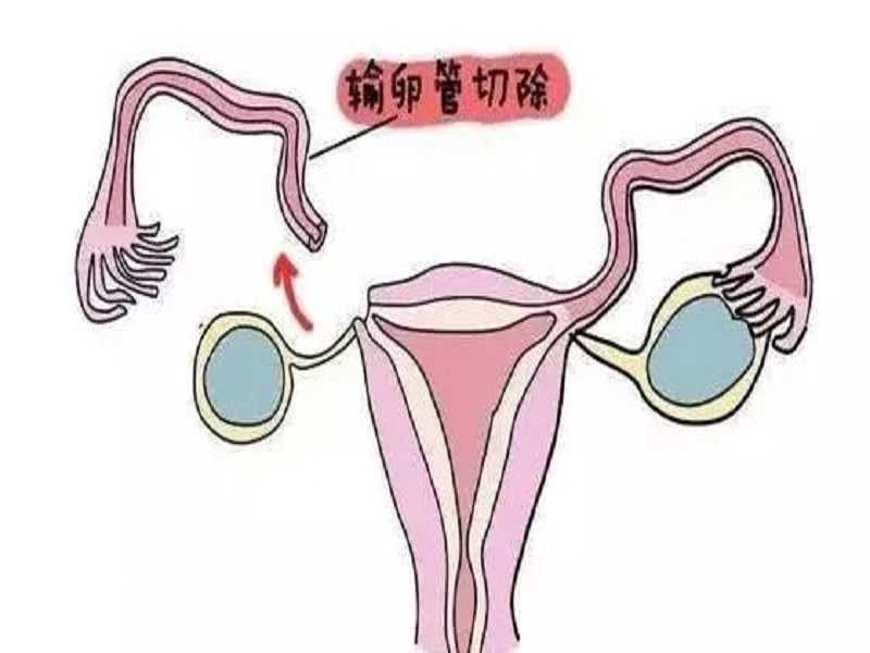 供卵试管婴儿步骤流程,广州供卵骗局