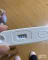 妊娠合并梅毒1