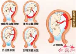 广州哪家代孕医院口碑好，广州的三代试管婴儿私立医院哪个最好？广州三代试
